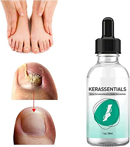 Kerassentials - Aceite para tratamiento de hongos en las uñas de los pies, tratamiento Kerassentials para uñas (1 unidad)
